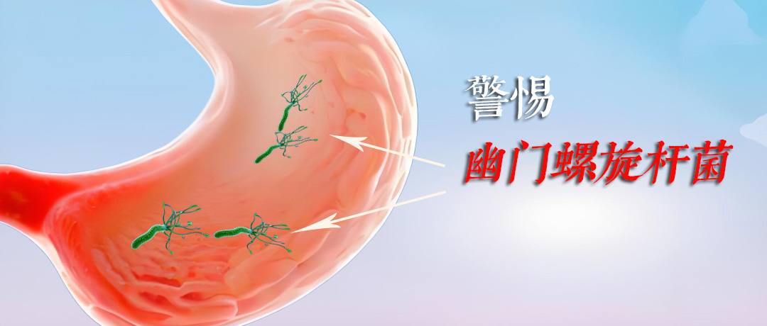 幽门螺杆菌阳性?治疗前必知的5个注意事项