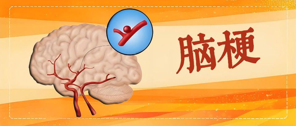 脑梗发作有先兆!这几个症状哪怕只占一条也要快就医