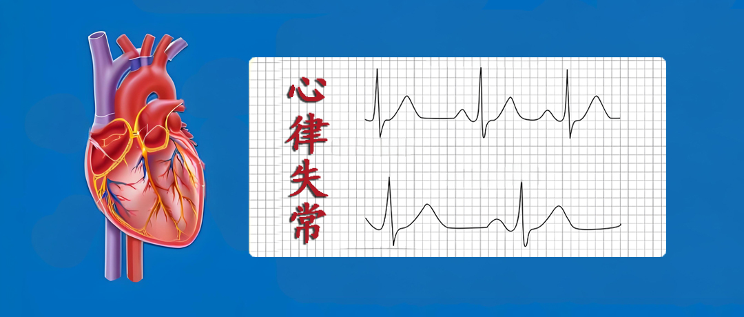 突然心悸头晕，当心心律失常，及时就医防意外