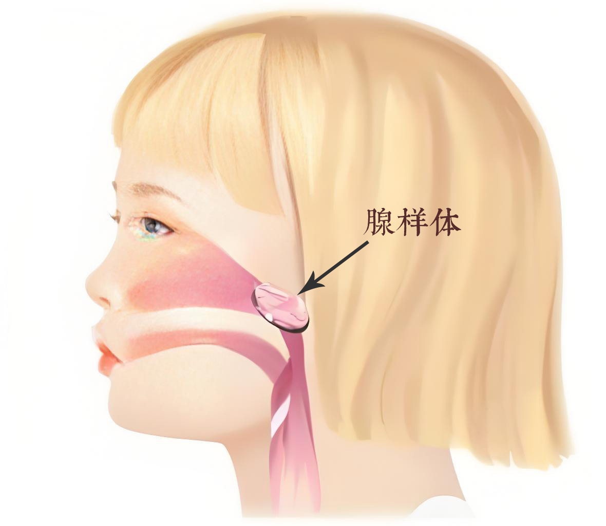 孩子长期鼻塞?警惕腺样体肥大的4个征兆
