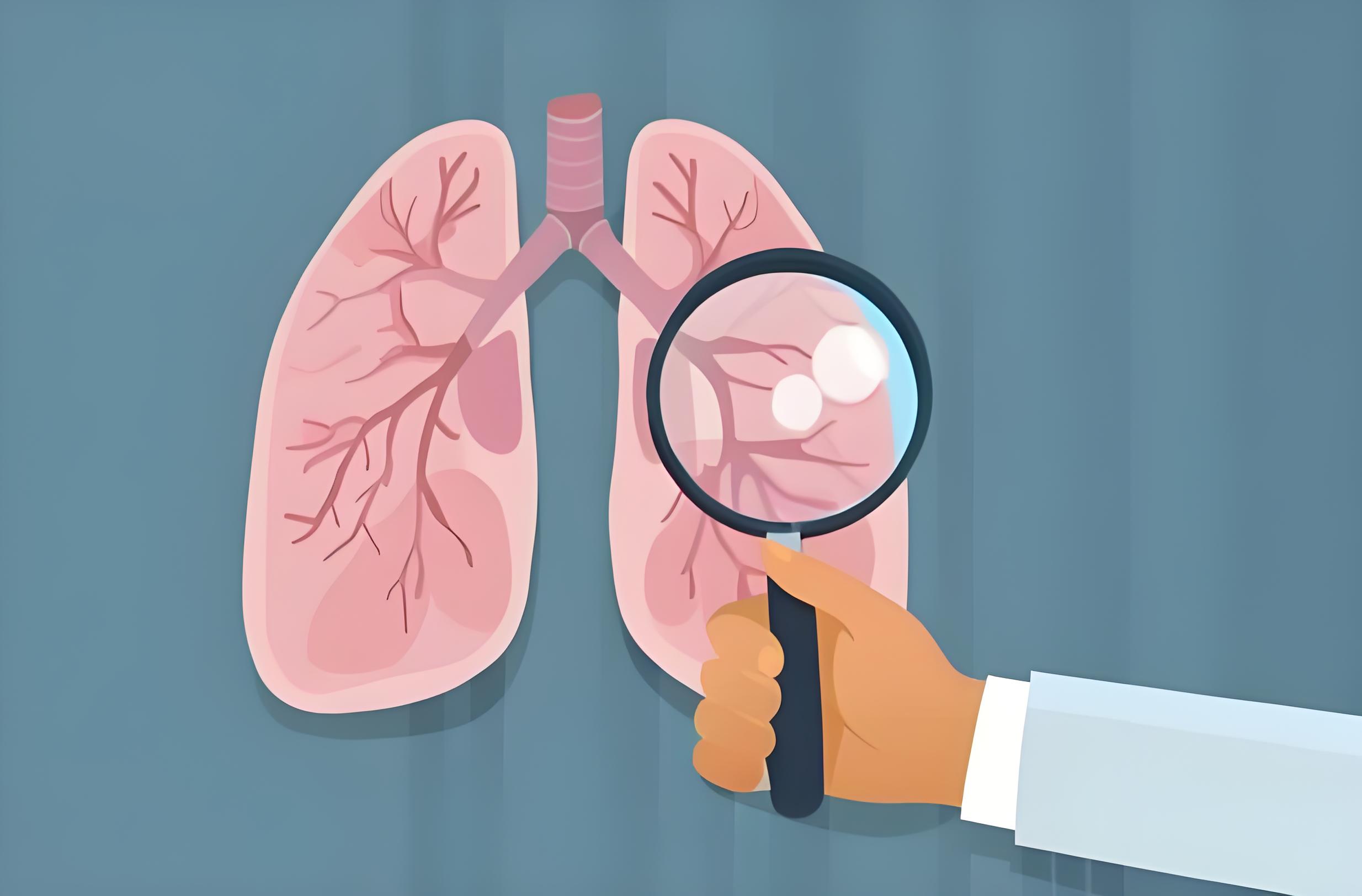 查出肺结节先别慌，但要注意这3件事，以免恶化