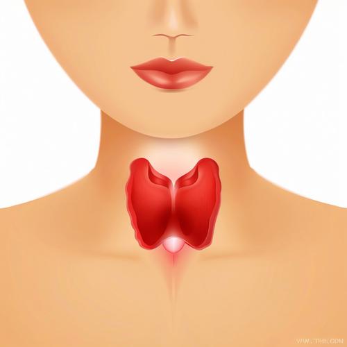 甲状腺结节高发，这5类人群需要定期筛查