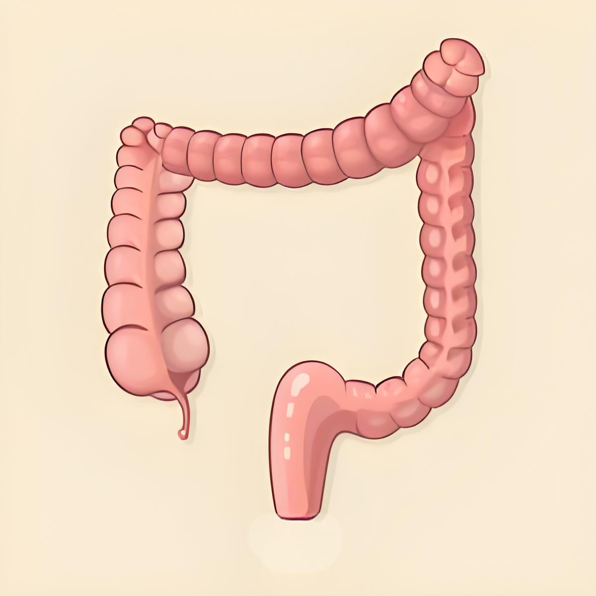 饭后出现这5个症状，警惕结直肠癌风险