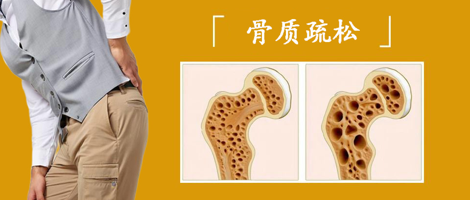骨质疏松疼痛难忍?这些缓解方法快收藏!