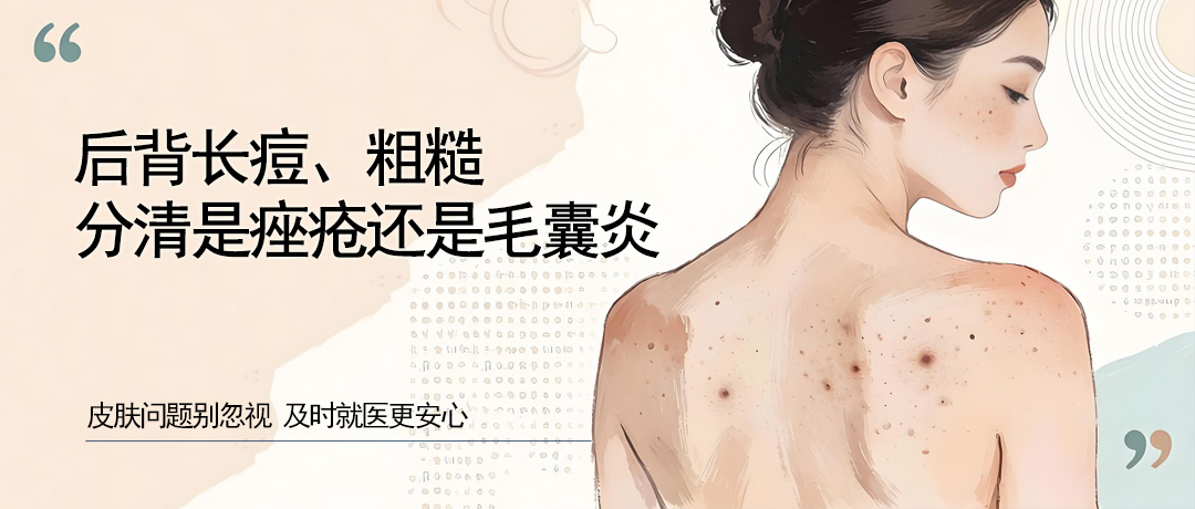 后背长痘、粗糙?分清是痤疮还是毛囊炎